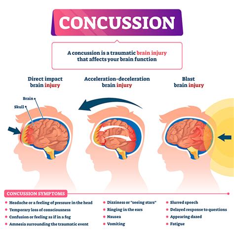 Researchers release new concussion protocols as fall sports are underway